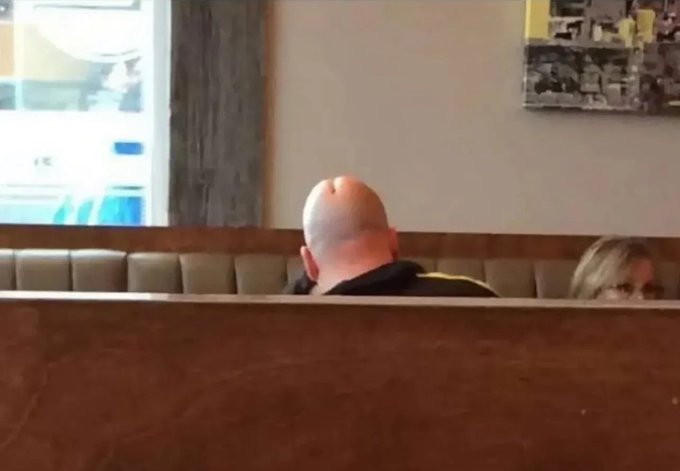 DICKHEAD