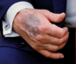 Hand